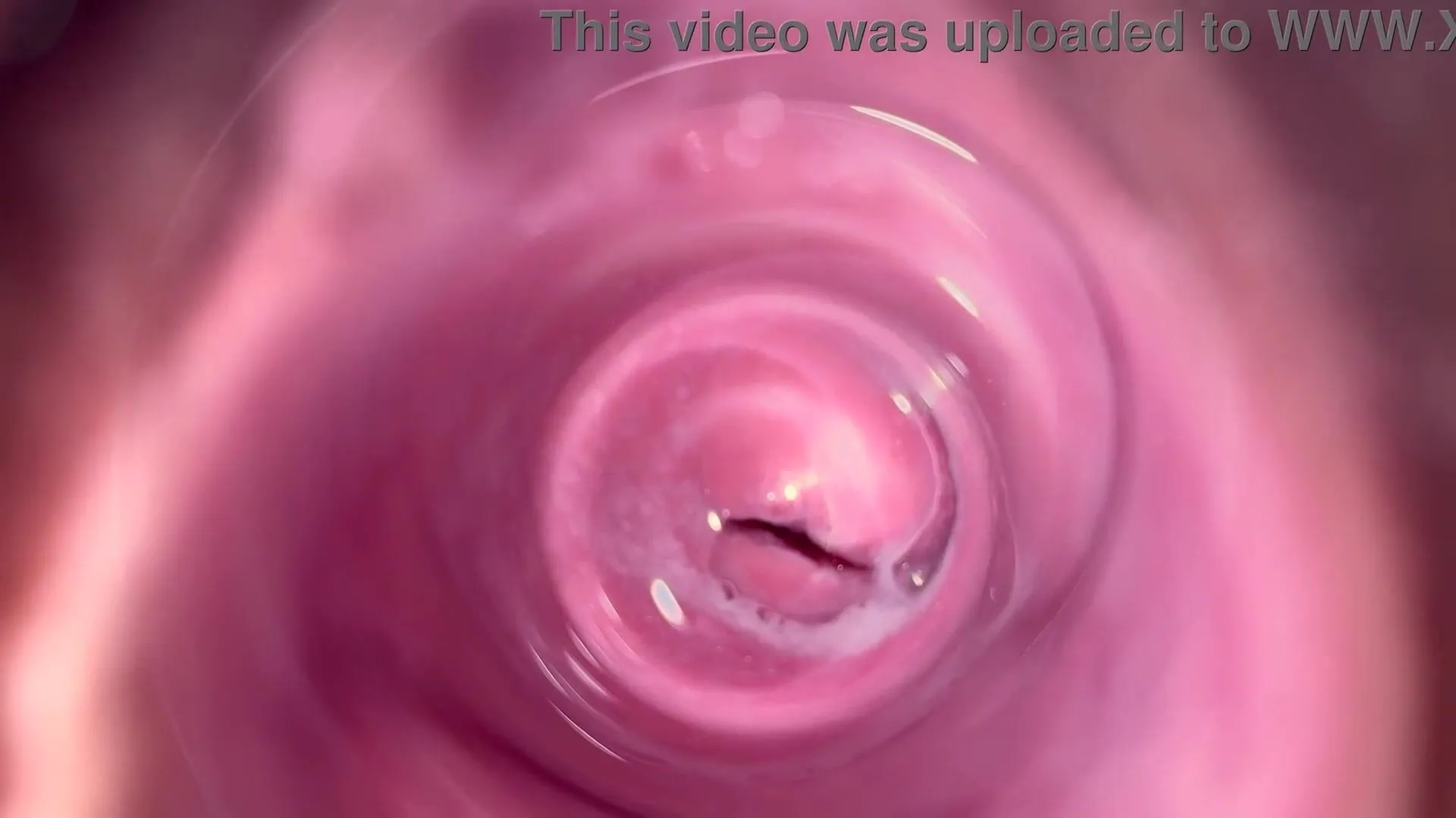 Internal camera inside vagina 